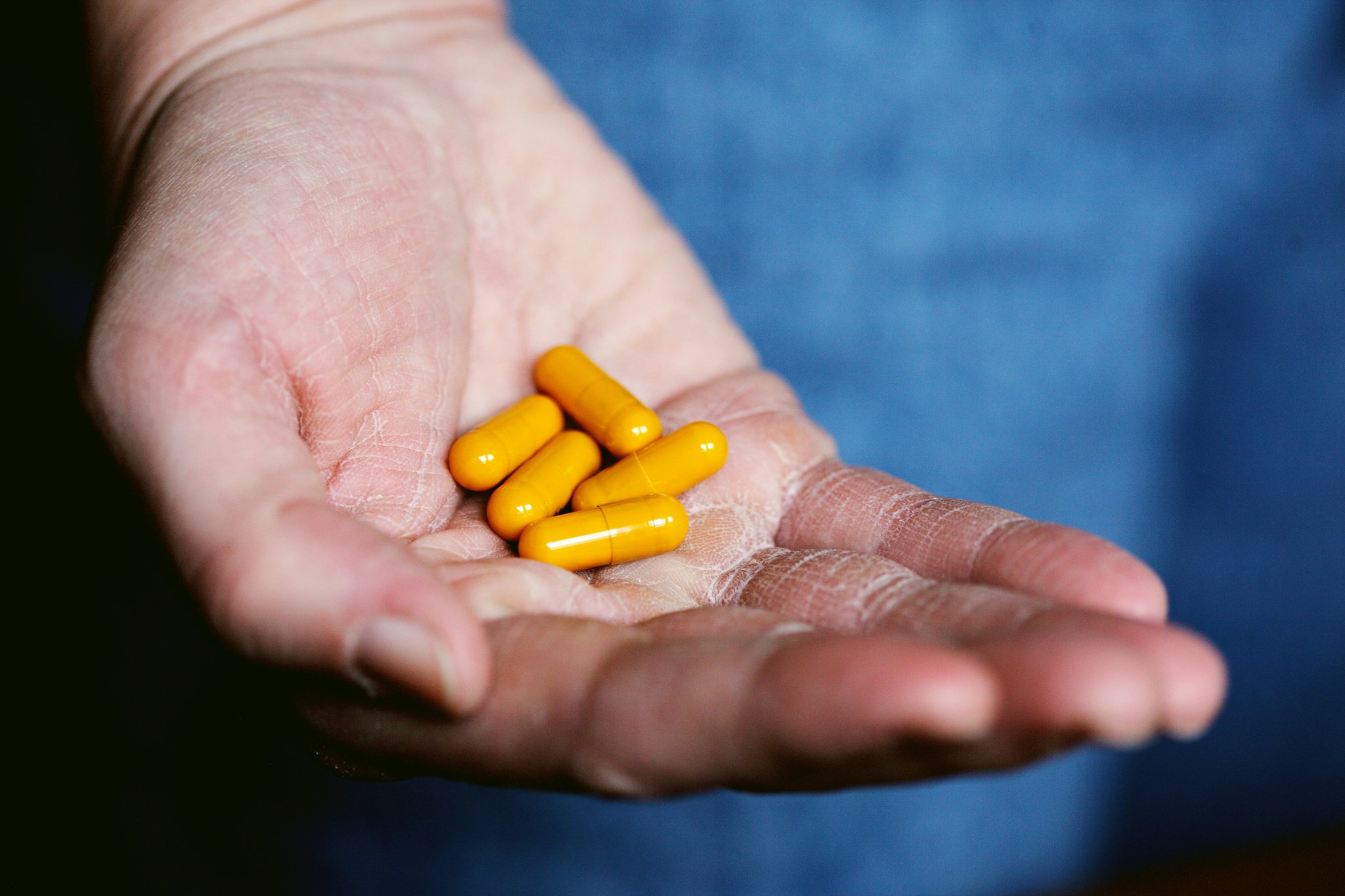 Turmeric Allergy Relief: How Pet Supplements Can Transform Your Furry Friend's Health